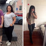 ¿Es posible recuperarse del hipotiroidismo?