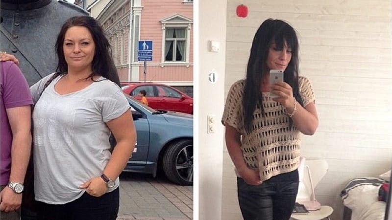 ¿Es posible recuperarse del hipotiroidismo?