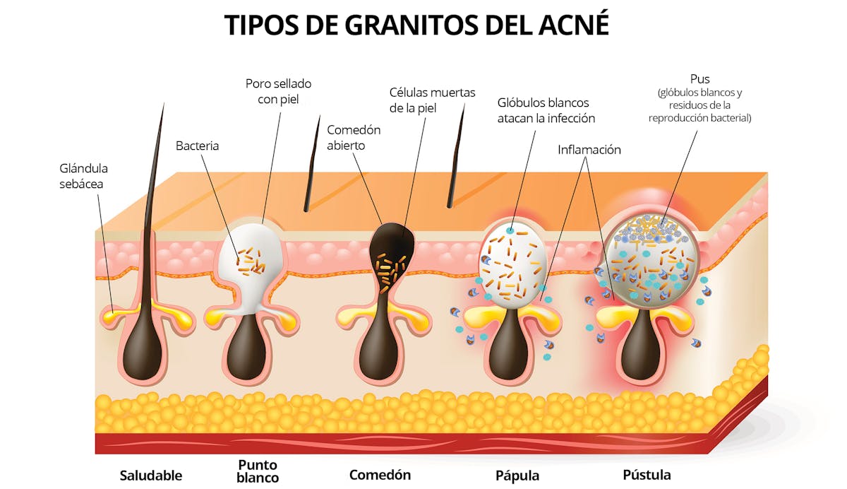 ¿la dieta cetosis es buena para el crecimiento del cabello? ¿la dieta cetosis es buena para el crecimiento del cabello?