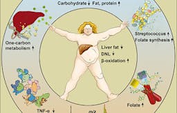 Nuevo estudio: ¿se puede corregir el hígado graso comiendo bajo en carbohidratos?