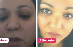 La dieta cetogénica: "He vuelto de entre los muertos"