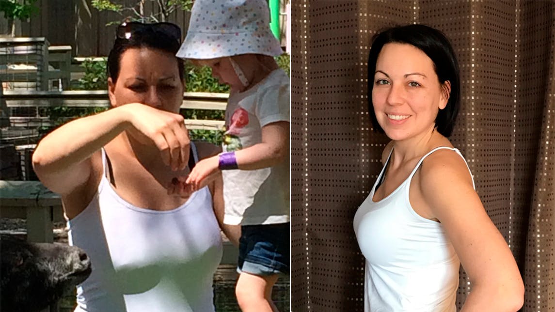 Cómo me convertí en una doctora que revierte la diabetes de tipo 2 con bajos carbohidratos