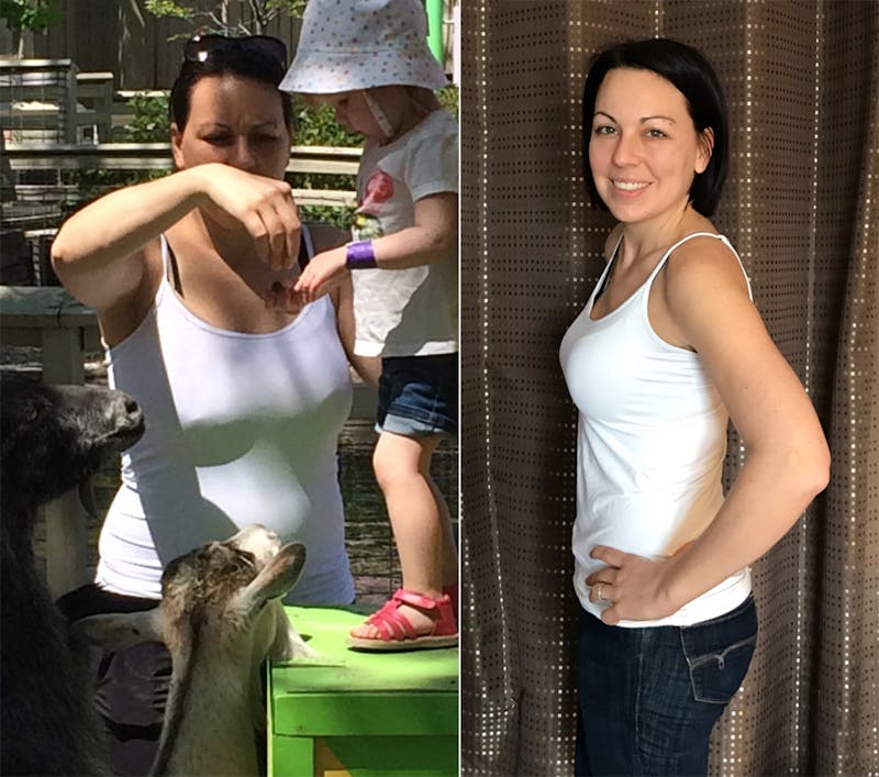 Antes y después doctora Evelyn