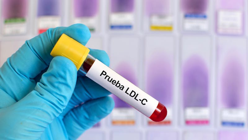 Prueba LDL-C