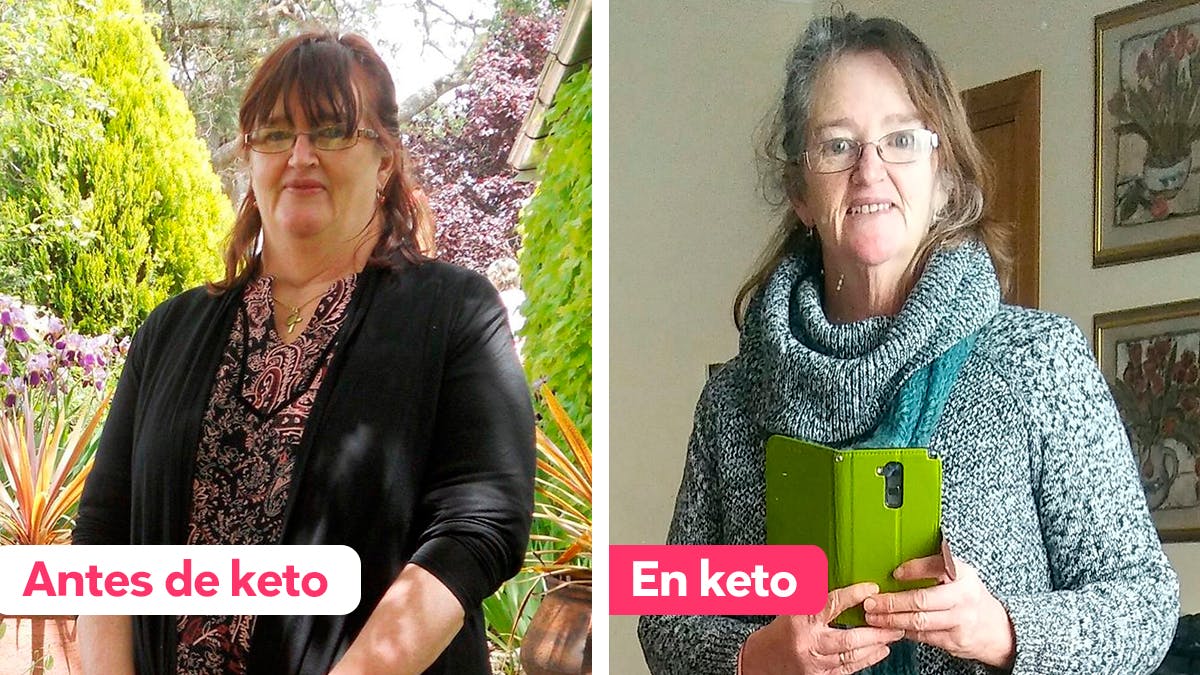 30 kg menos en un año con la dieta cetogénica