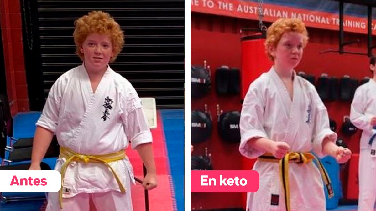 “Las crisis epilépticas cesaron de forma inmediata y no han vuelto”