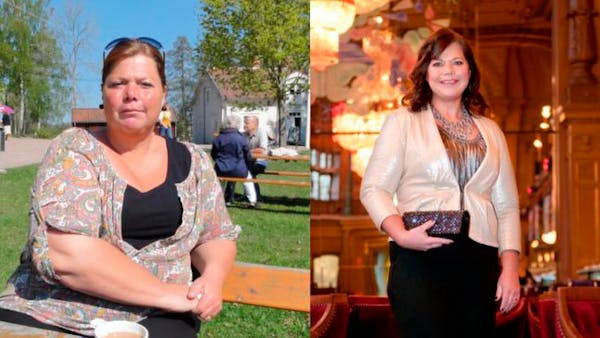 Cómo bajar 50 kg con la dieta baja en carbos en vez de cirugía gástrica