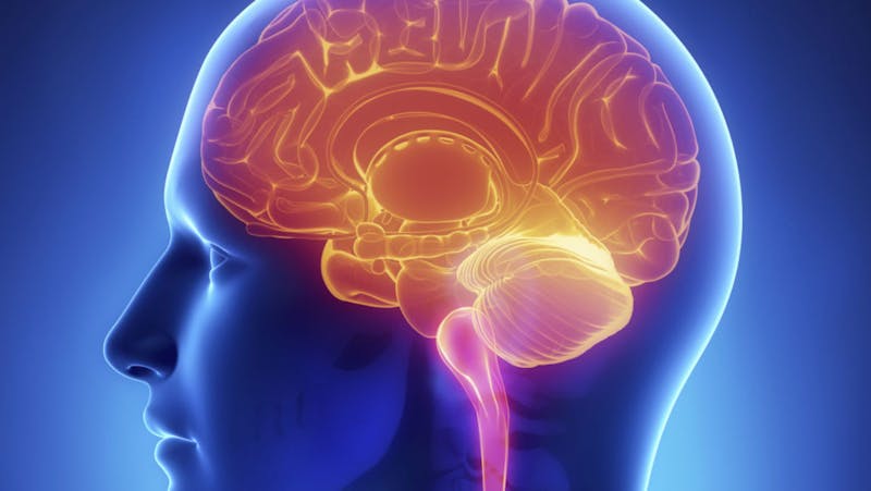 Cerebro
