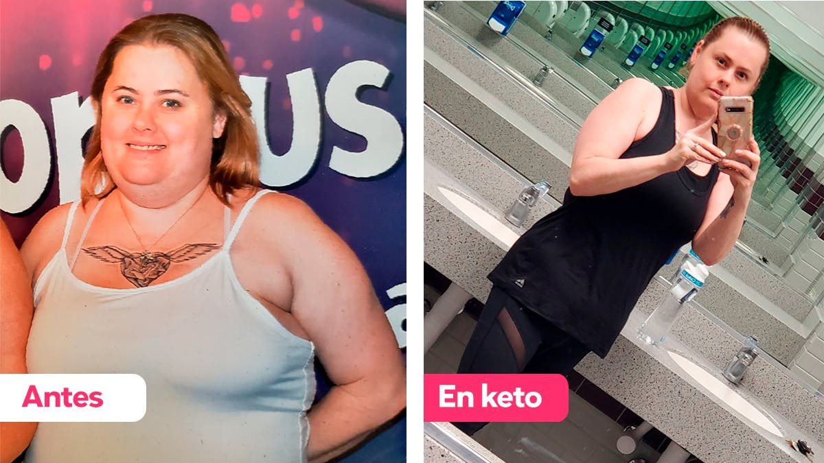 Cómo Amy perdió 40 kg y dejó la medicación
