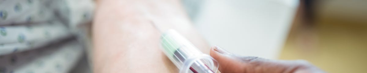 Cómo bajar el colesterol LDL en una dieta baja en carbohidratos