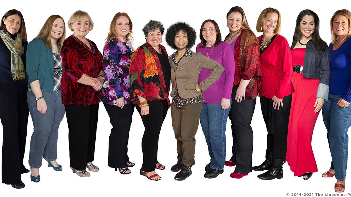 ¿Podrías tener lipedema?