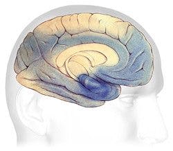 Alzheimer och hjärnan Alzheimer och hjärnan
