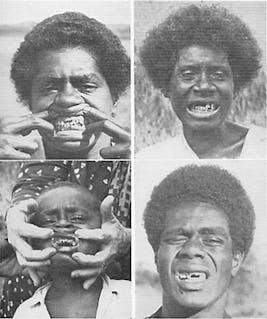 Fiji-fig31 Fiji-fig31