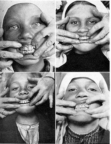 Schweiz-fig3 Schweiz-fig3