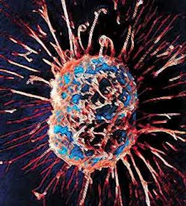 Cancercell Cancercell