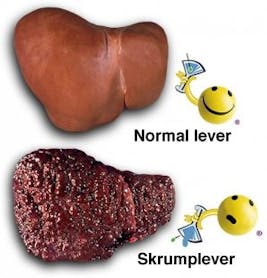 skrumplever skrumplever