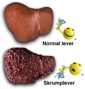 Läsk / juice lika farligt som alkoholmissbruk?