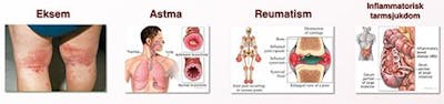 Omega 3 och inflammatoriska sjukdomar