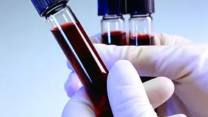 Mina hälsovärden efter 5 år på LCHF