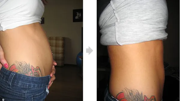 Boten för svullna magar?