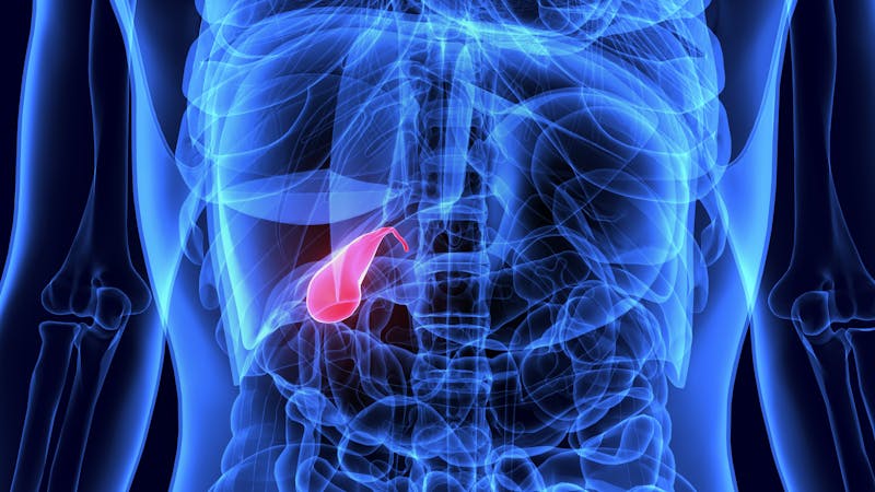 3d illustration of Los Angeles Hernia Gallbladder Sue