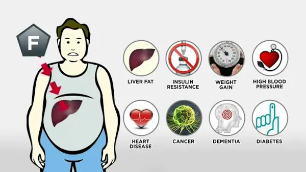 Sjukligt sött – Ny briljant video med dr Lustig