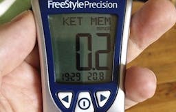 Ny leksak: en ketonmätare