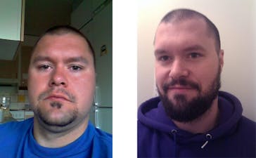 Minus 14 kilo med LCHF – med mindre träning än vanligt!