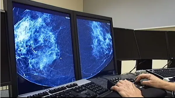 Vanlig blodtrycksmedicin kopplas till bröstcancer