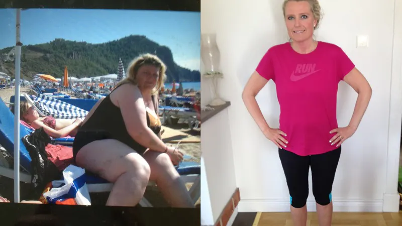 Kan huden hänga med 70 kilos viktminskning med LCHF?