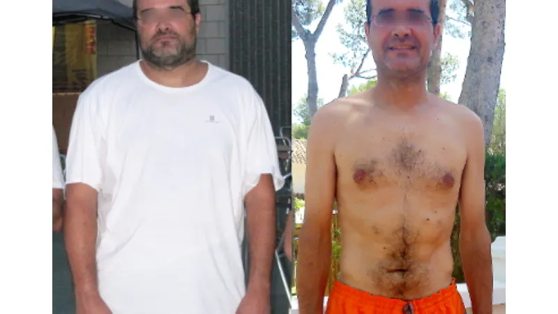 "Min fettlever försvann"