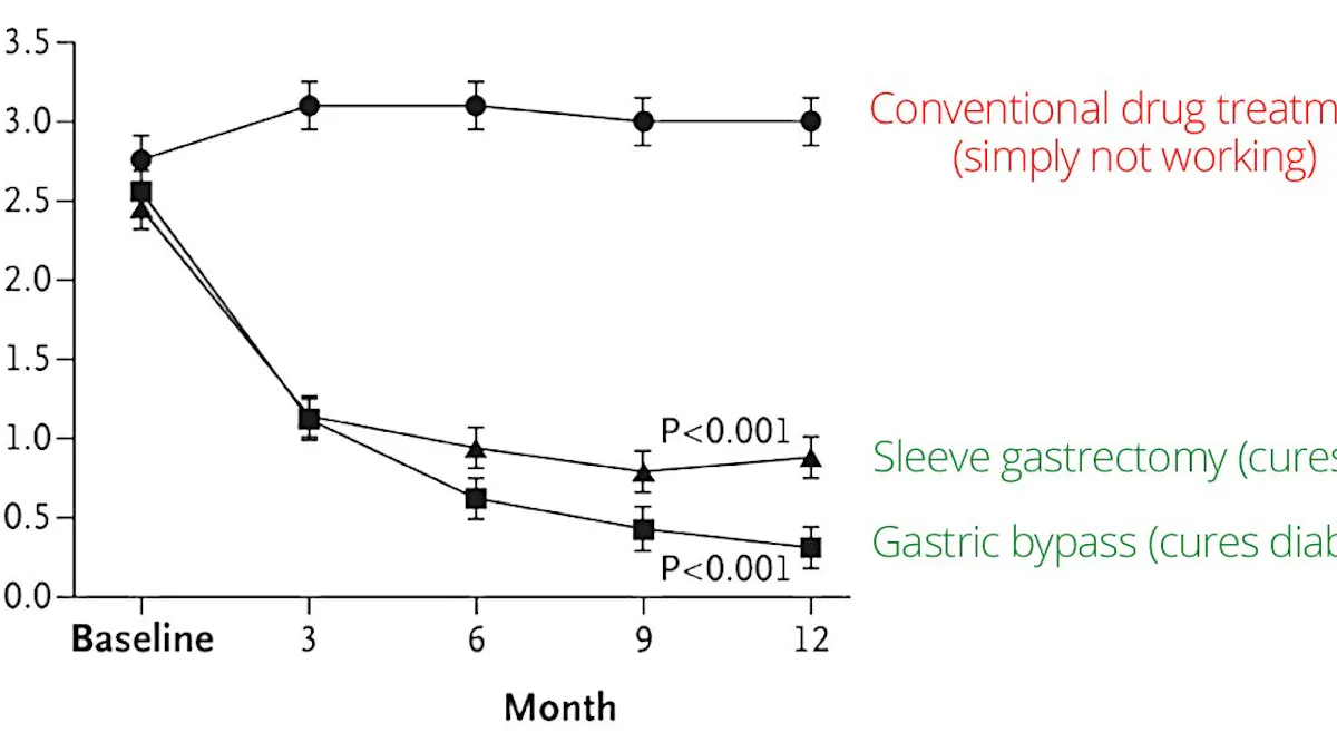 Typ 2-diabetes går att bota