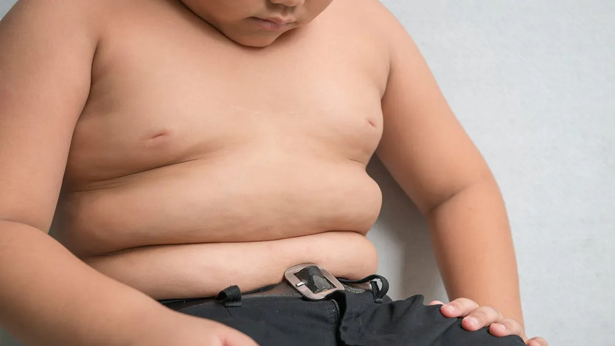 Chockerande barnfetmatrend – och den fortsätter uppåt!