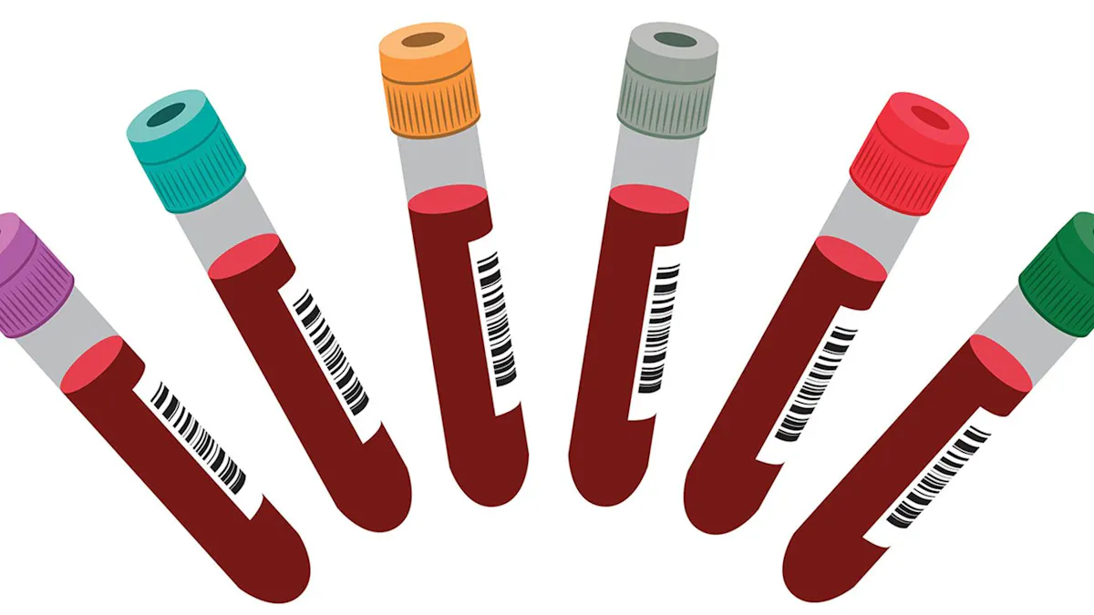 Fasta och <strong>kolesterol</strong>