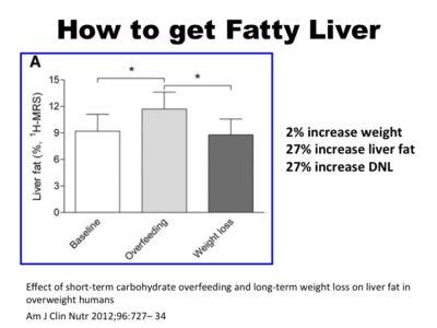 FattyLiver1-400×300