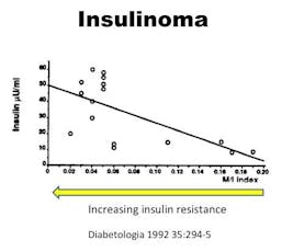Insulinoma