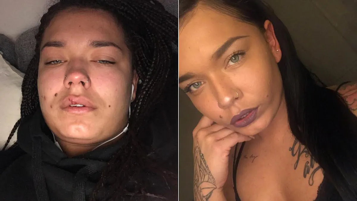 "Tack till min diabetes som lärde mig att leva ett sockerfritt liv"