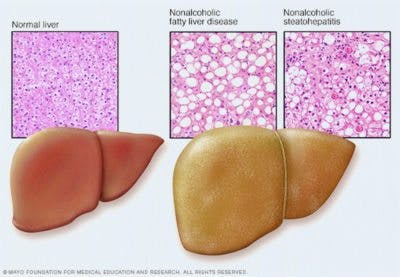 Untitled-4-4-400×277