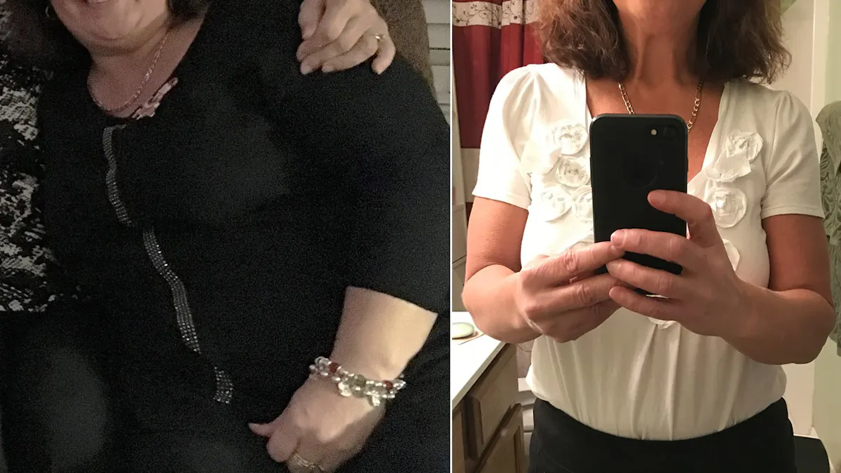 "Allt mitt sug efter maten som gjorde mig överviktig och sjuk har försvunnit"