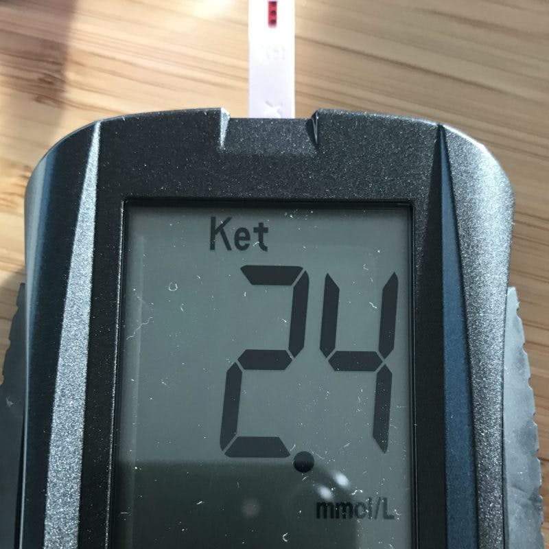 Hur tidigt kan du kön bebisen
