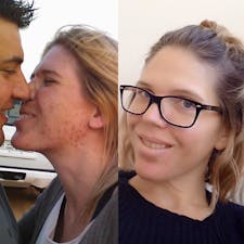 "En kombination av LCHF och paleo läkte min hy"