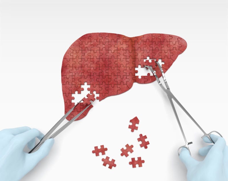 liver-disease-1-1600×1270