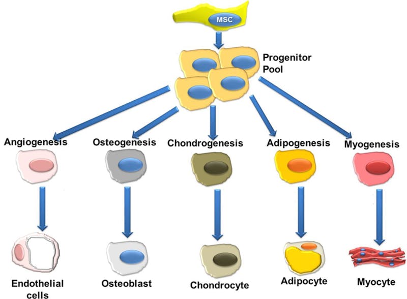 Bild 4, Celldysdifferentiering