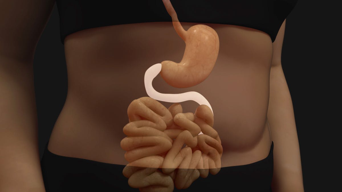 5. Sju steg till ketos