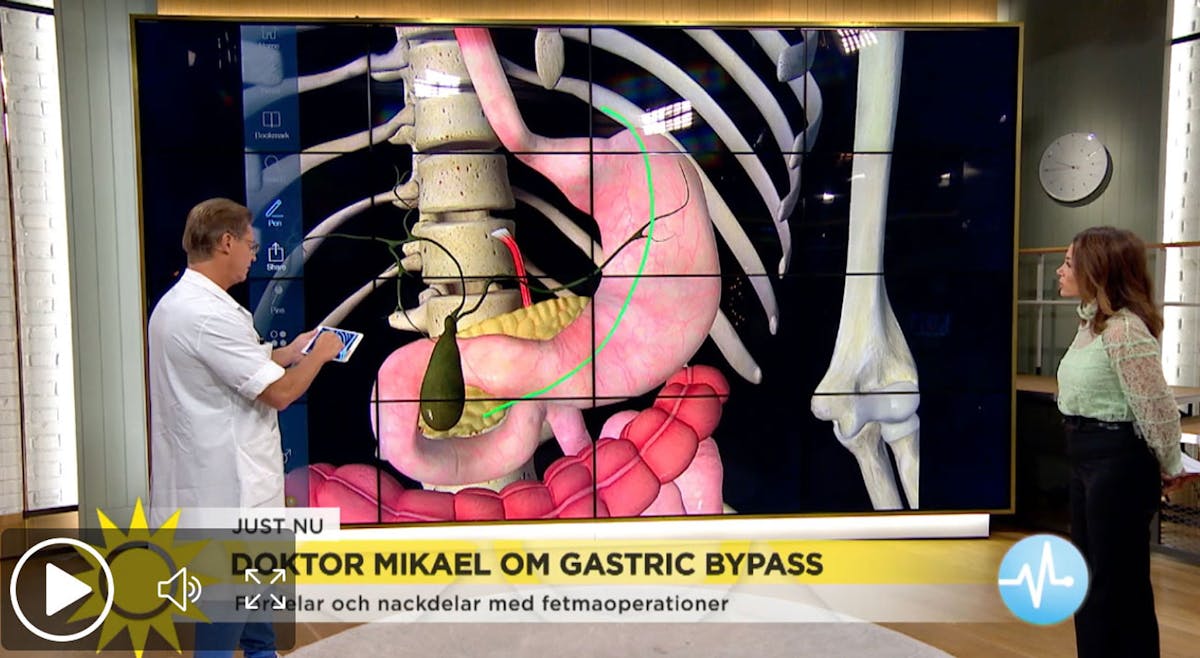 Viktoperationen fyller 50 år: "En del lever i misär"