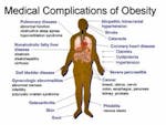 Medical complications of obesity