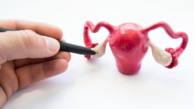 Doctor or teacher points of ballpoint pen on ovaries on anatomical model of internal female sex organs. Ovaries organ where eggs are produced, male and female hormones, as well as different diseases