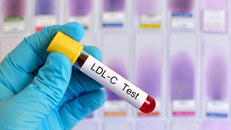 LDL-C test