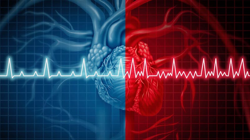 Atrial Fibrillation