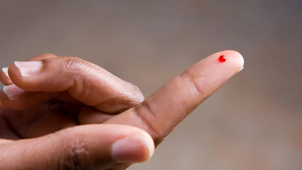 Olika metoder för ketonmätning kan ge olika resultat. Spelar det någon roll?